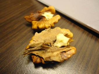  Paggamot ng thyroid gland na may walnut septum
